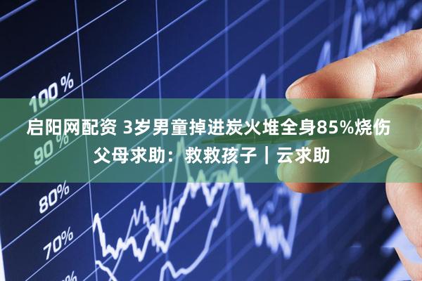 启阳网配资 3岁男童掉进炭火堆全身85%烧伤 父母求助：救救孩子｜云求助